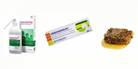 Флюс: що робити і як лікувати пухлину в домашніх умовах