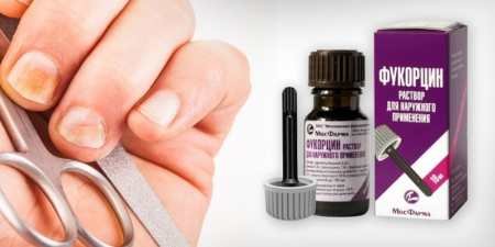 Фукорцин від грибка нігтів: інструкція для лікування