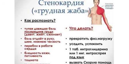 Грудна жаба — симптоми і ознаки хвороби