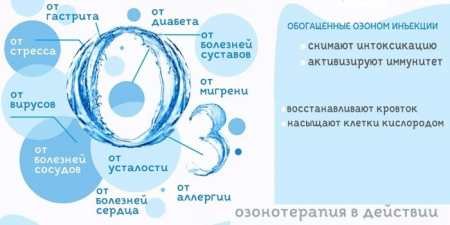 Озонотерапія – показання і протипоказання для крапельниць, уколів і камери