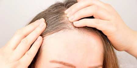 Рання сивина у жінок — причини явища в молодому віці