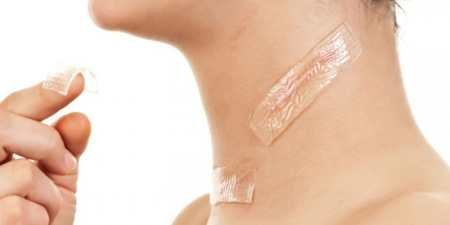 Рубці на обличчі: засоби для видалення і лікування