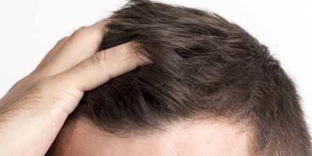 Воші: все, що ви не знали, але соромилися запитати