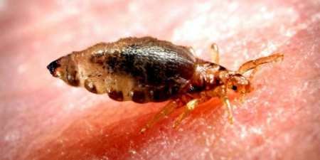 Воші: все, що ви не знали, але соромилися запитати