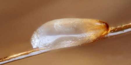 Воші: все, що ви не знали, але соромилися запитати