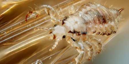 Воші: все, що ви не знали, але соромилися запитати