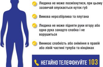 Ознаки інсульту: перша допомога для швидкого реагування