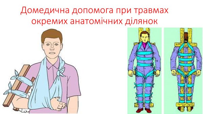 Ефективна домедична допомога при травмах: захист окремих анатомічних ділянок Ефективна домедична допомога при травмах: захист окремих анатомічних ділянок