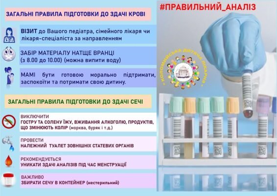 Чи можна їсти перед здачею сечі: вказівки для точності аналізів