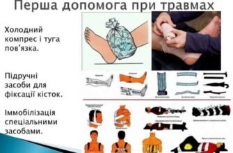 Перша допомога при травмах: ефективні поради та інструкції дій