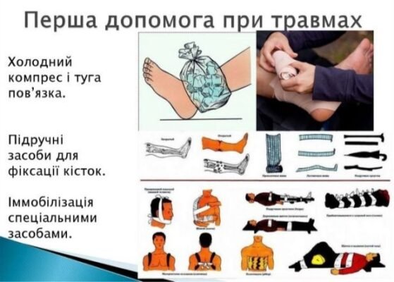 Перша допомога при травмах: ефективні поради та інструкції дій Перша допомога при травмах: ефективні поради та інструкції дій