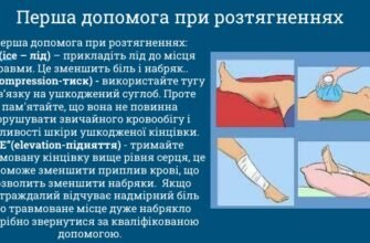 Ефективна перша допомога при вивиху: ключові поради та дії