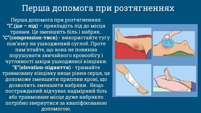Перша допомога в разі вивиху: докладний посібник для кожного