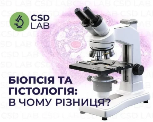 Гістологія і біопсія: в чому різниця та взаємозв’язок? Гістологія і біопсія: в чому різниця та взаємозв’язок?