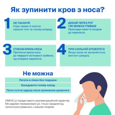 Перша допомога при кровотечі з носа: як правильно зупинити кров Перша допомога при кровотечі з носа: як правильно зупинити кров