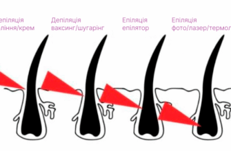 Епіляція і депіляція: у чому різниця та як обрати метод?