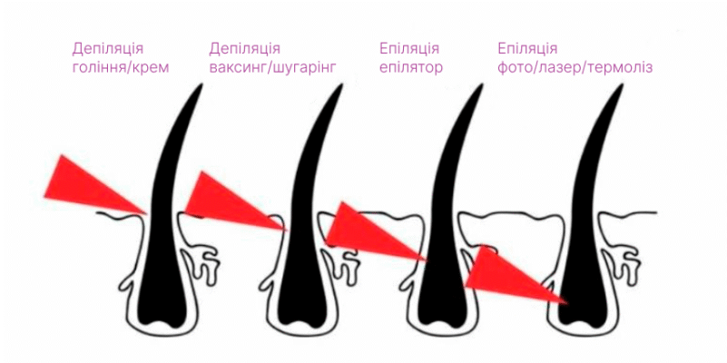 Епіляція vs Депіляція: Основні Відмінності та Що Обрати? Епіляція vs Депіляція: Основні Відмінності та Що Обрати?