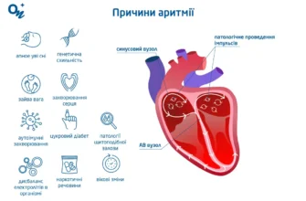 Ефективна невідкладна допомога при миготливій аритмії: ключові кроки