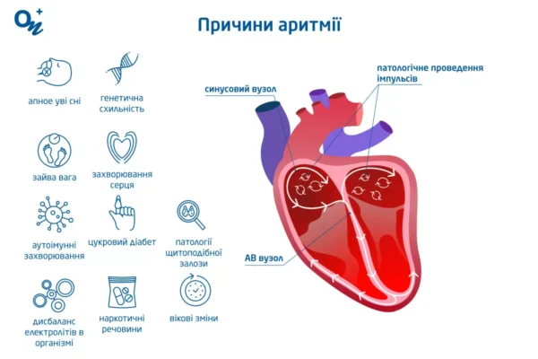 Ефективна невідкладна допомога при миготливій аритмії: ключові кроки