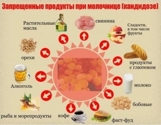 Що не можна їсти при кандидозі кишечника: список заборонених продуктів