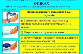 Ефективна допомога при опіках: як швидко полегшити стан та уникнути ускладнень