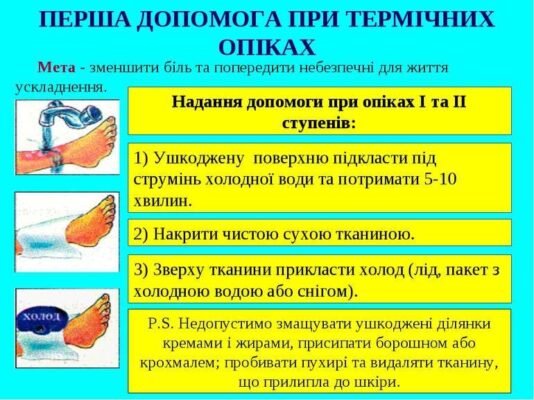 Ефективна допомога при опіках: як швидко полегшити стан та уникнути ускладнень Ефективна допомога при опіках: як швидко полегшити стан та уникнути ускладнень