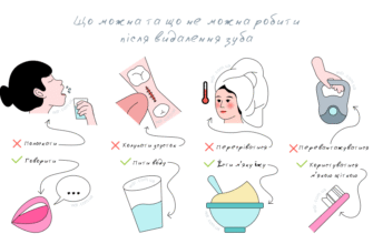 Що не можна їсти після видалення зуба мудрості: перелік продуктів