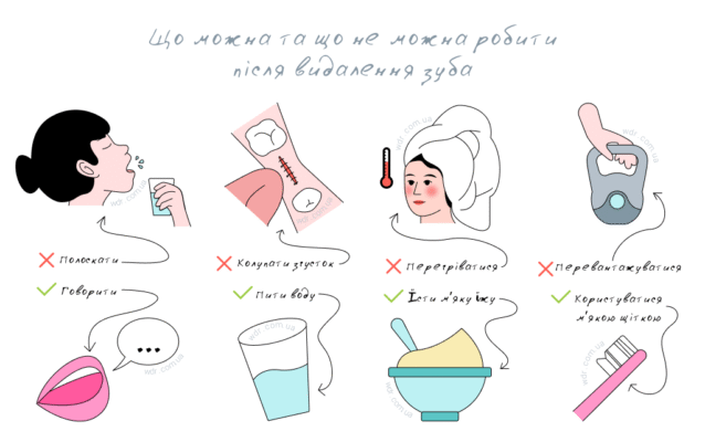 Що не можна їсти після видалення зуба мудрості: перелік продуктів