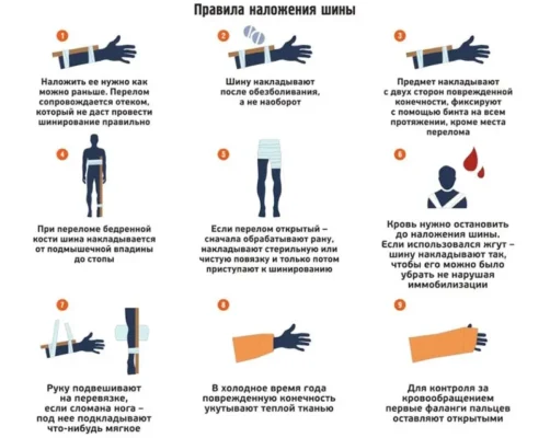 Домедична допомога при переломах: ефективні поради та техніки Домедична допомога при переломах: ефективні поради та техніки