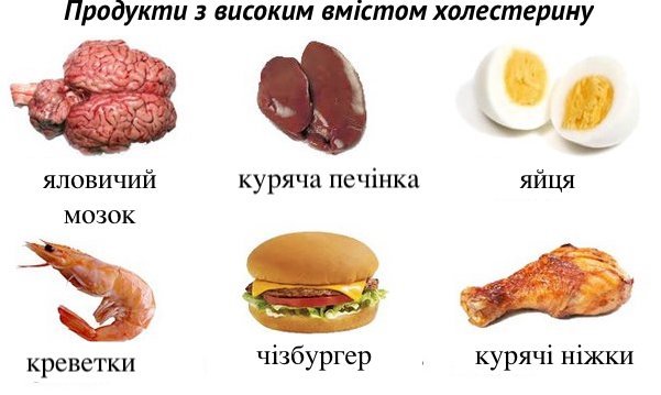 Що можна їсти при високому холестерині: корисні поради та продукти Що можна їсти при високому холестерині: корисні поради та продукти