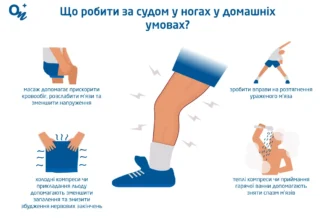 Перша допомога при судомах ніг: ефективні методи та поради