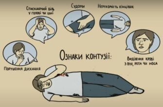 Перша допомога при контузії: основні кроки і рекомендації