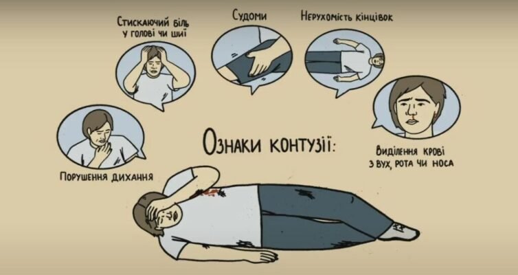 Перша допомога при контузії: основні кроки і рекомендації