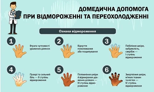 Перша медична допомога при обмороженні: основні правила та поради
