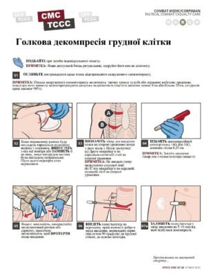 Перша допомога при пневмотораксі: поради для швидкої реакції