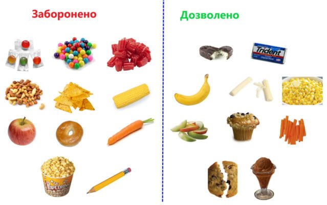 Що не можна їсти з брекетами: заборонені продукти та поради стоматологів Що не можна їсти з брекетами: заборонені продукти та поради стоматологів